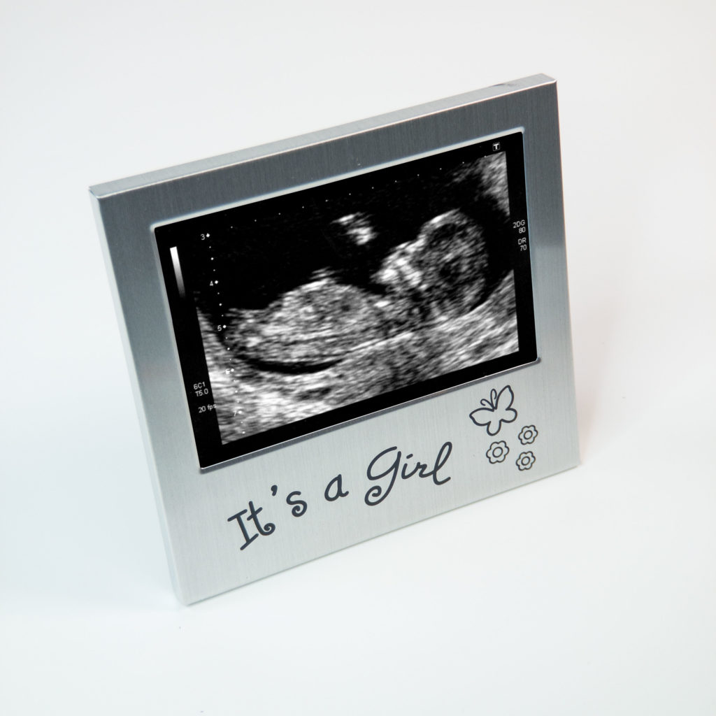 Baby Scan Photo Frame ABC4D