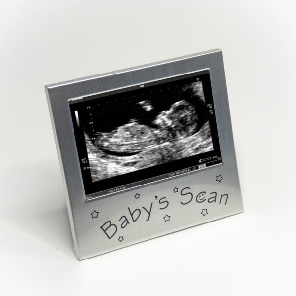Baby Scan Photo Frame ABC4D